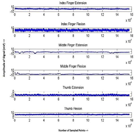 Figure 1 From Classification Of Extension And Flexion Positions Of