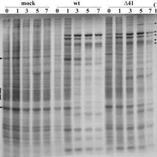 Growth Kinetics Of Prv Wt And Vhs Mutant Virus A Pk Cells