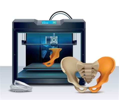 Patient Specific Orthopaedic Surgery An Economic Analysis On 3d Printing Devices Published In