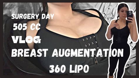 Breast Augmentation 360 Lipo My Real Experience Youtube