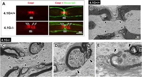 Microscopic structure of paranodes next to the nodes of Ranvier (NRs ...