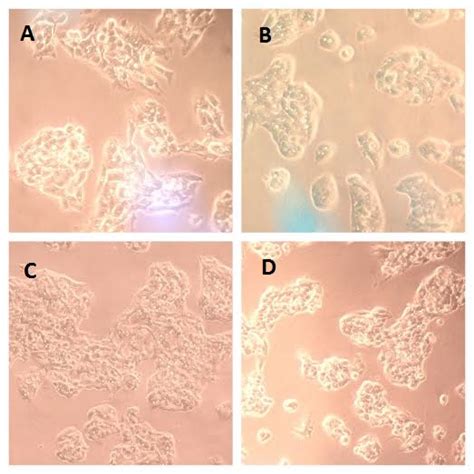 Can someone help with HepG2 cells morphology?