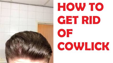 How To Get Rid Of A Cowlick On Your Hairline Youtube