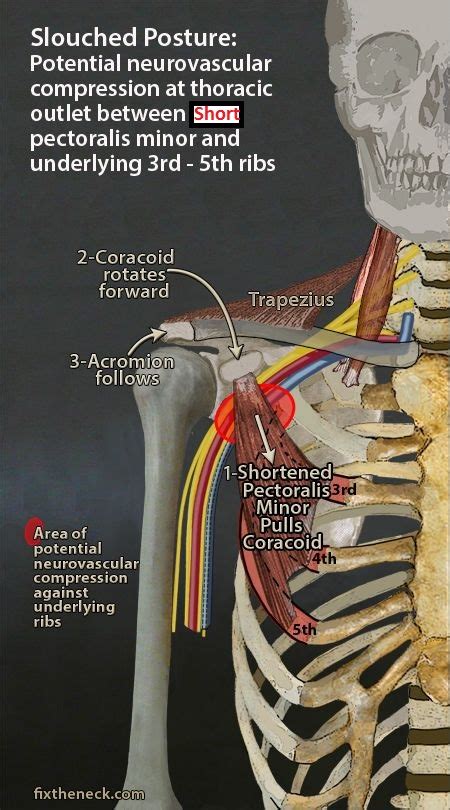 Unlocking The Front Body Via The Coracoid Process Mindful Mvmnt