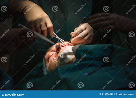 Plastic Eye Surgery for Men Stock Image - Image of health, operation ...