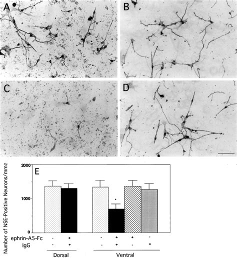 Selective Inhibition Of Spinal Cord Neurite Outgrowth And Cell Survival