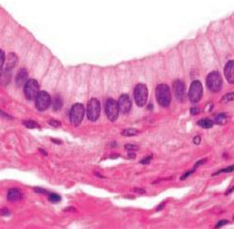 Epithelia Tissue Figures Lab Exam Flashcards Quizlet