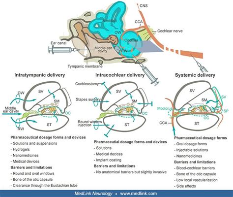 Noise Induced Hearing Loss Medlink Neurology