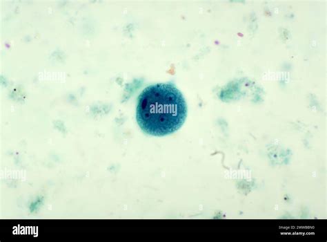 This Trichrome Stained Photomicrograph Depicted A Mature Entamoeba Coli Cyst Containing Five