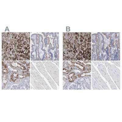 Sulfamidase SGSH Antibody NBP1 83164 Bio Techne