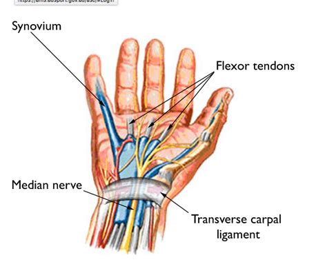 Carpal Tunnel Syndrome — Rayner And Smale