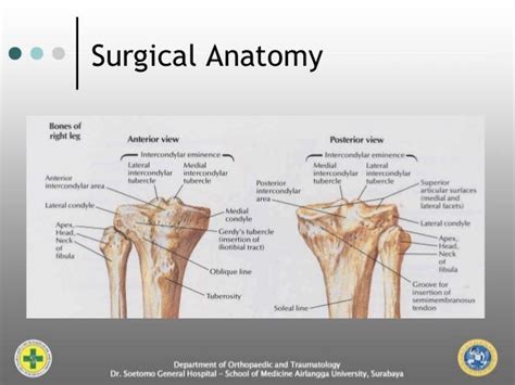 Lateral Tibial Plateau Anatomy