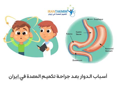 9 أسباب للدوخة بعد عملية التكميم في إيران لا تعرفونها تكميم المعدة