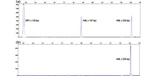 Molecular Sexing Using Capillary Electrophoresis A Electropherogram Of Download Scientific