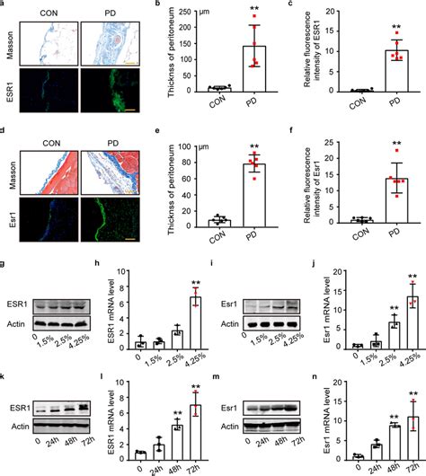 ESR1 Was Upregulated In The Peritoneal Mesothelial Cells After PDF