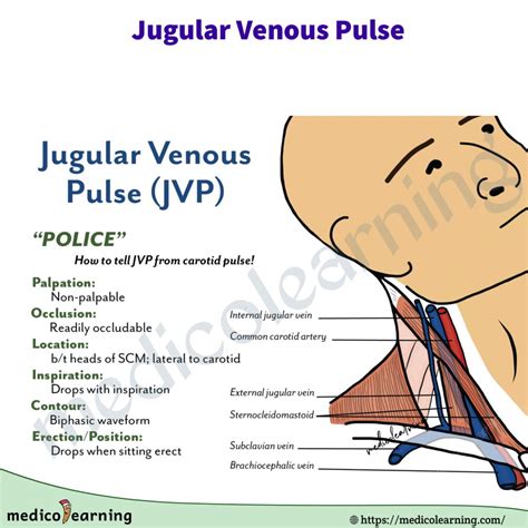 jugular venous pulse (JVP) – MedicoLearning