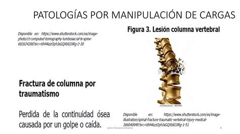 Manejo Manual De Cargas E Higiene Postural 1 PPT