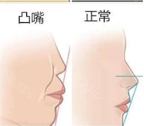 俗語「娶妻莫娶翹翹嘴，嫁漢別嫁天庭壘」中的天庭壘指啥？可信嗎 壹讀