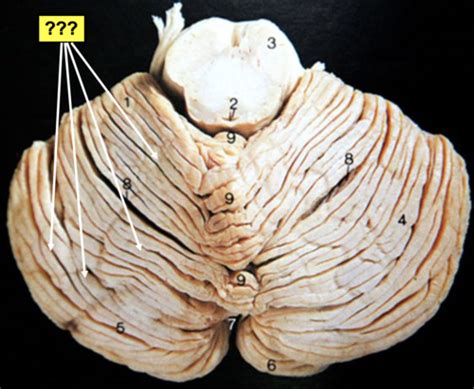 Foundations In Neuroscience Practical Flashcards Quizlet