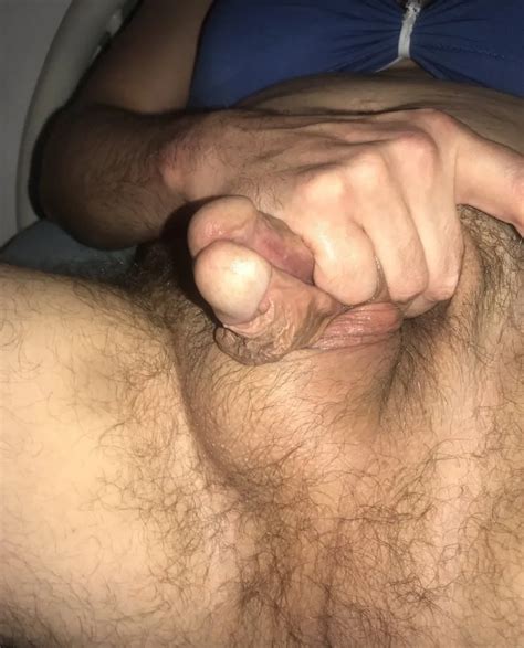 Subincision Gallery Nude Pics XHamster