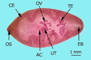 Parasitology 101 Paragonimus Westermani