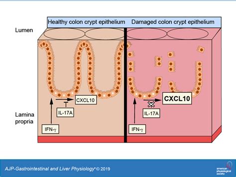 IFN γ and IL 17A regulate intestinal crypt production of CXCL10 in the