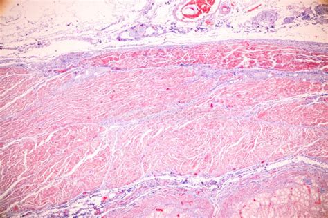 Tissue of Stomach Human Under the Microscope in Lab. Stock Photo - Image of bowel, histology ...