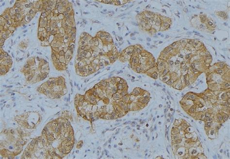 IL-13 Antibody (PA5-100831)