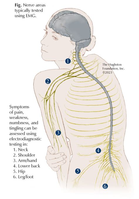 EMG Testing Questions For A Specialist Hughston Clinic