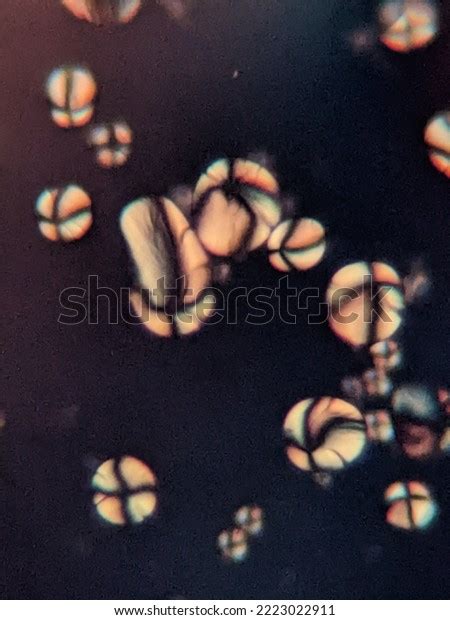 Photo Starch Grains Under Microscope Stock Photo 2223022911 | Shutterstock