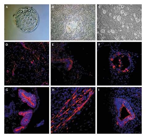 Derivation Of Embryonic Stem Cell Lines From Human Blastocysts NEJM