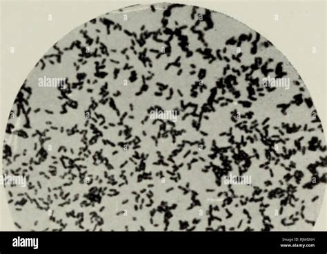 Bacillus mycoides hi-res stock photography and images - Alamy