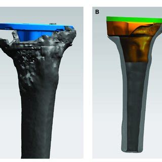 Process Of Designing The D Printed Porous Tantalum Cone A