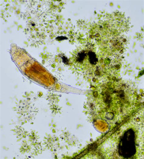 Microorganisms In Pond Water Under Microscope