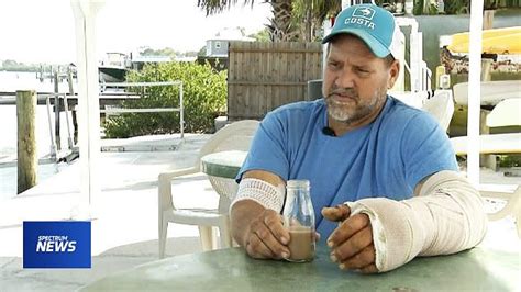 Florida Man Contracts Rare Flesh Eating Bacteria After Fish Hook Gets