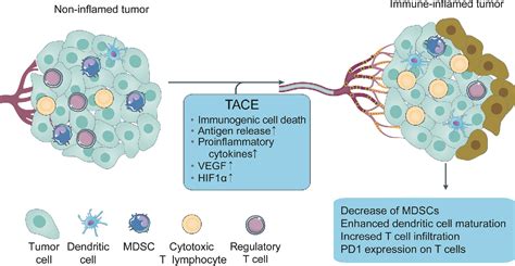 Figure From Role Of Transarterial Chemoembolization In The Treatment