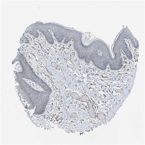 Tissue Expression Of Ldlr Staining In Skin The Human Protein Atlas