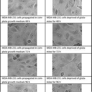 Light Microscopy Images Demonstrating Morphology Of MDA MB 231 Cells