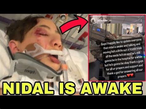 Nidal Wonder Is FINALLY AWAKE MOVING After A TERRIBLE CAR ACCIDENT