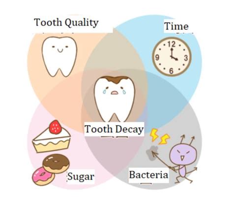 The Causes and Prevention of Tooth Decay – SEMI- Sapporo English ...