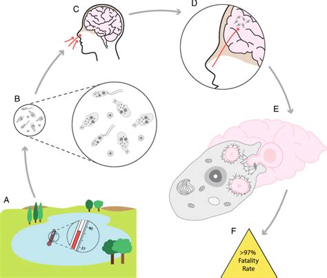 Infection Of Humans By Naegleria Fowleri A N Fowleri Is Found In Download Scientific