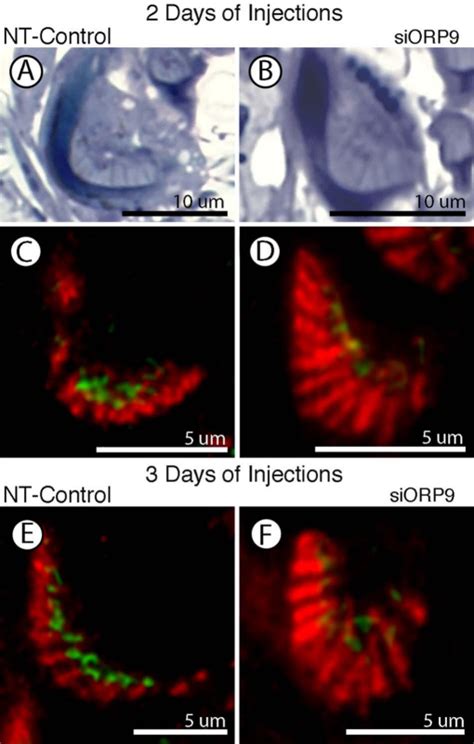 Orp Knockdown Delays The Maturation Of Junction Related Endocytic