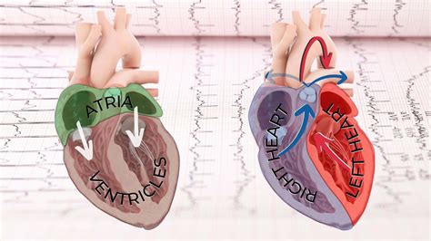 Nuclear Stress Test Myocardial Perfusion Imaging Demystified