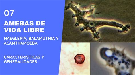 Amebas De Vida Libre 7 0 Balamuthia Mandrillaris Naegleria