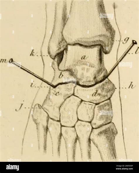 Pr Cis Iconographique De M Decine Op Ratoire Et D Anatomie Chirurgicale