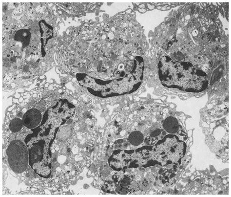 Electron Micrograph Of A Purified Kupffer Cell Suspension Note The