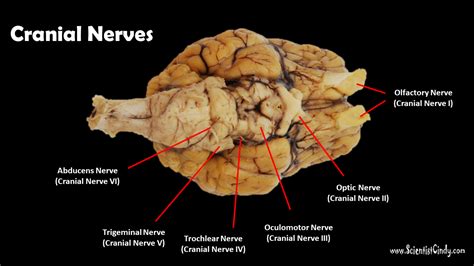 Sheep Brain Sagittal View