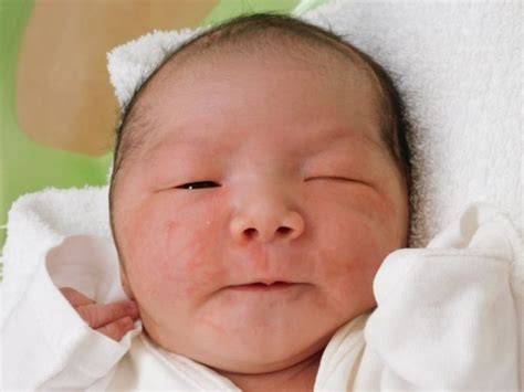 令和5年3月28日 日本海病院産婦人科