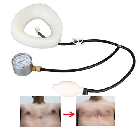 Vacuum Bell Pectus Excavatum Brace Improve Sternum Deformity Support