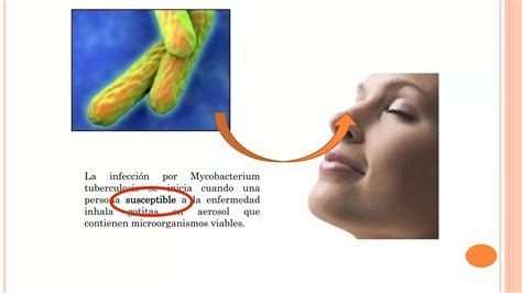 Tuberculosis Latente Dr Casanova Ppt